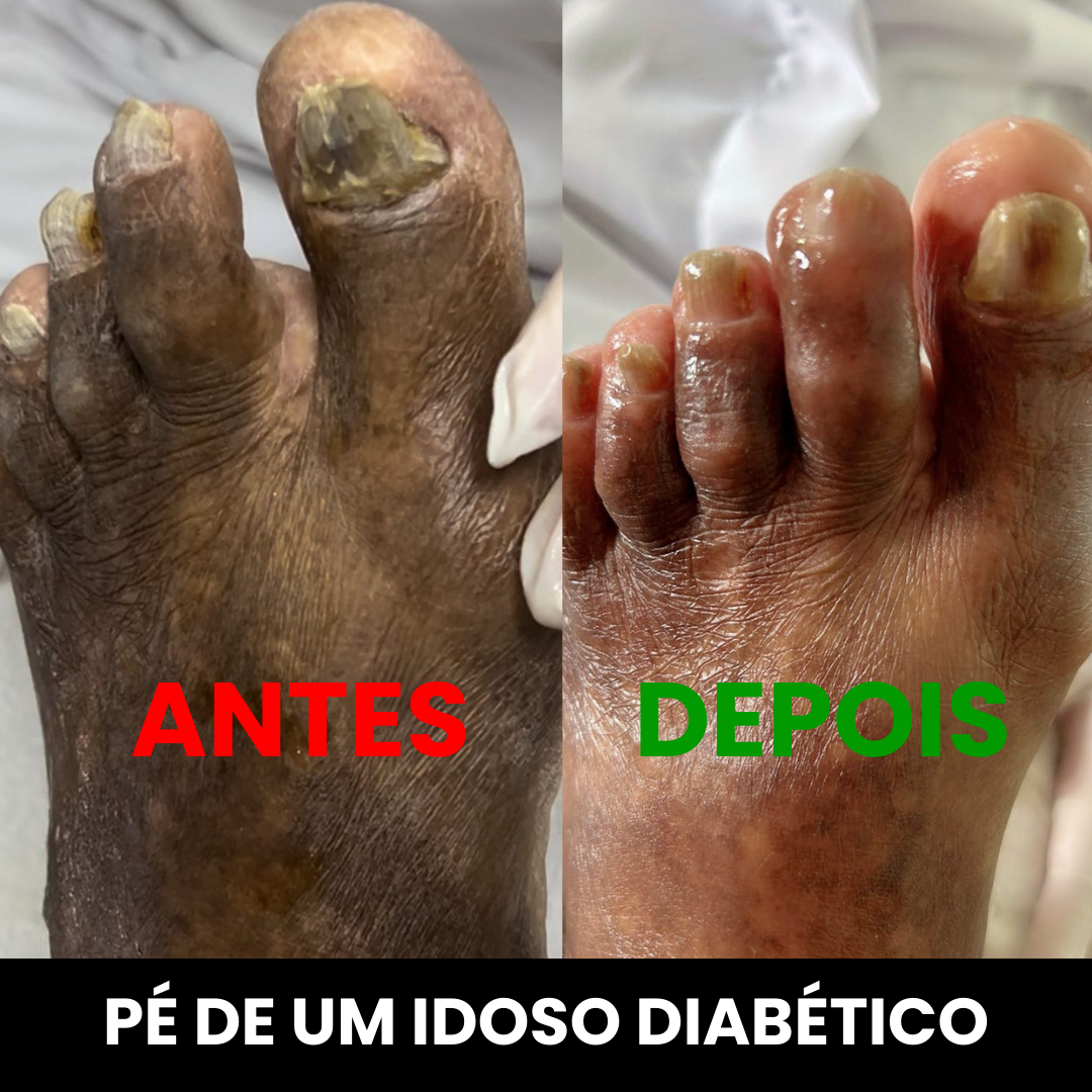 ANTES (7)