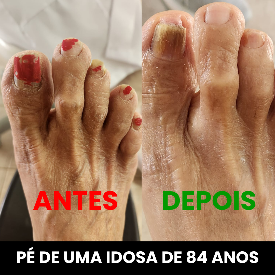 ANTES (8)