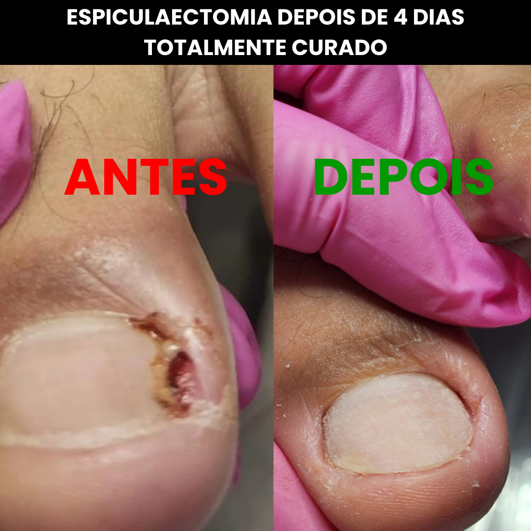 ANTES (9)